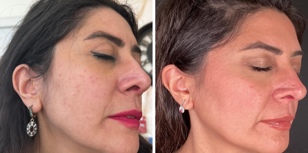 Oceanside Before and After